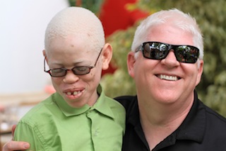 Peter Ash and a Tanzanian child with albinism